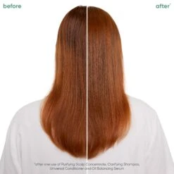 Biolage Scalp Sync Oil Balancing Serum 50ml 11 Biolage Scalp Sync Oil Balancing Serum 50ml -Goldwell Shop 2 0c38ff8e bae9 4ef1 84ad 58e33780b71d