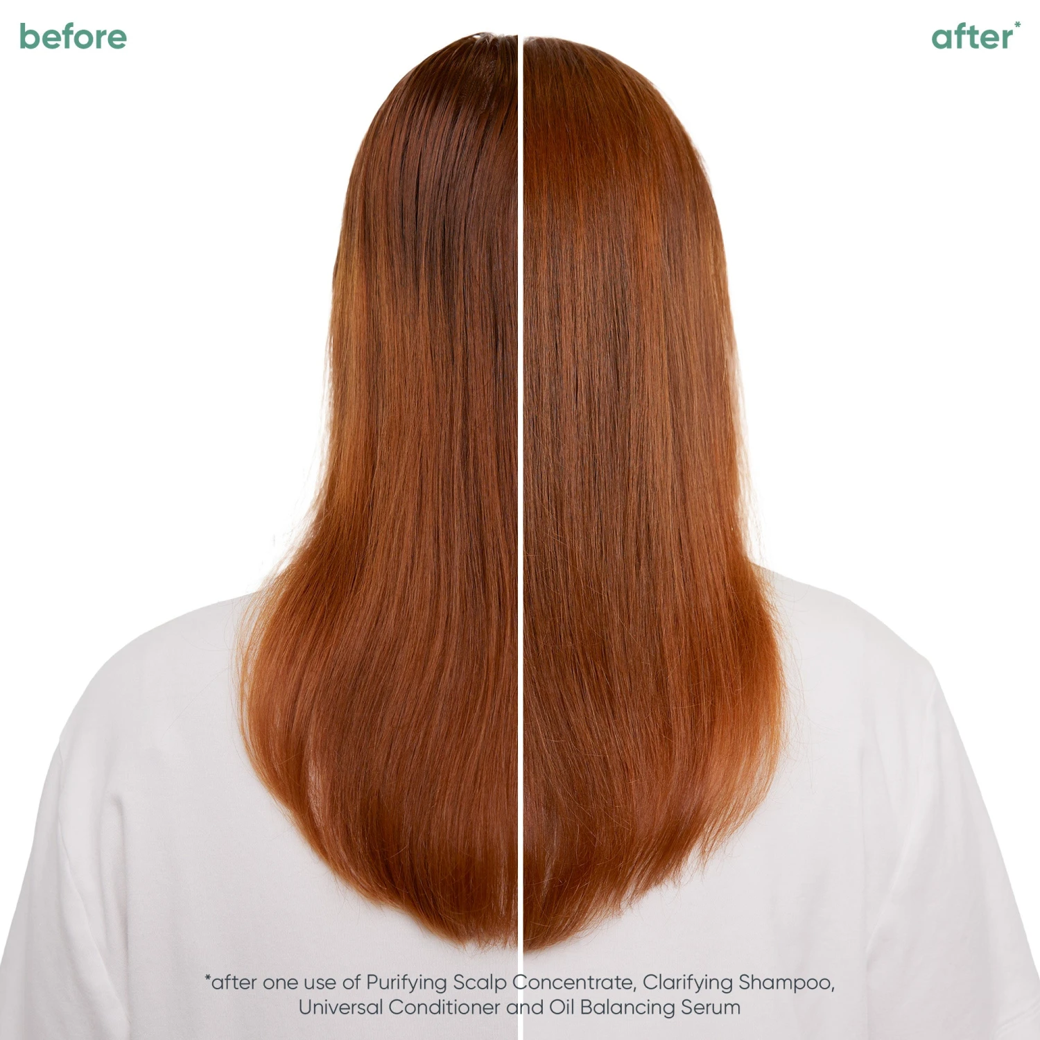 Biolage Scalp Sync Oil Balancing Serum 50ml 5 Biolage Scalp Sync Oil Balancing Serum 50ml - Image 3