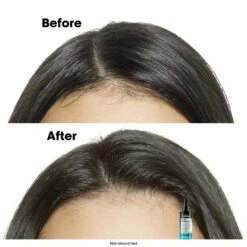 L'Oréal Professionnel Scalp Advanced Anti-Oily Spray 90ml -Goldwell Shop 3474637219833 EN 3