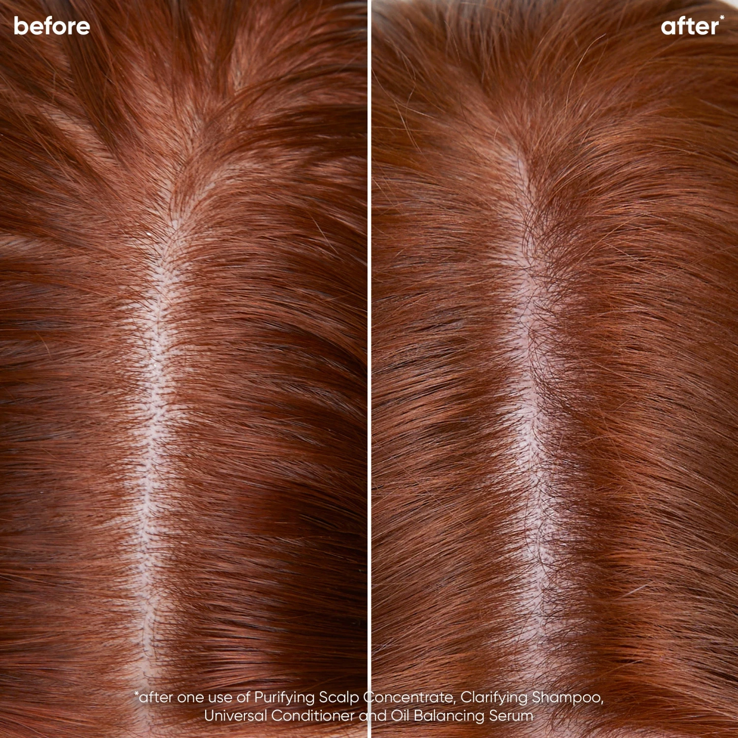 Biolage Scalp Sync Oil Balancing Serum 50ml 4 Biolage Scalp Sync Oil Balancing Serum 50ml - Image 2