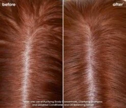 Biolage Scalp Sync Clarifying Shampoo 400ml 11 Biolage Scalp Sync Clarifying Shampoo 400ml -Goldwell Shop Biolage 2023 Scalp Sync Oily Before After Shannon Closeup 968x828 1